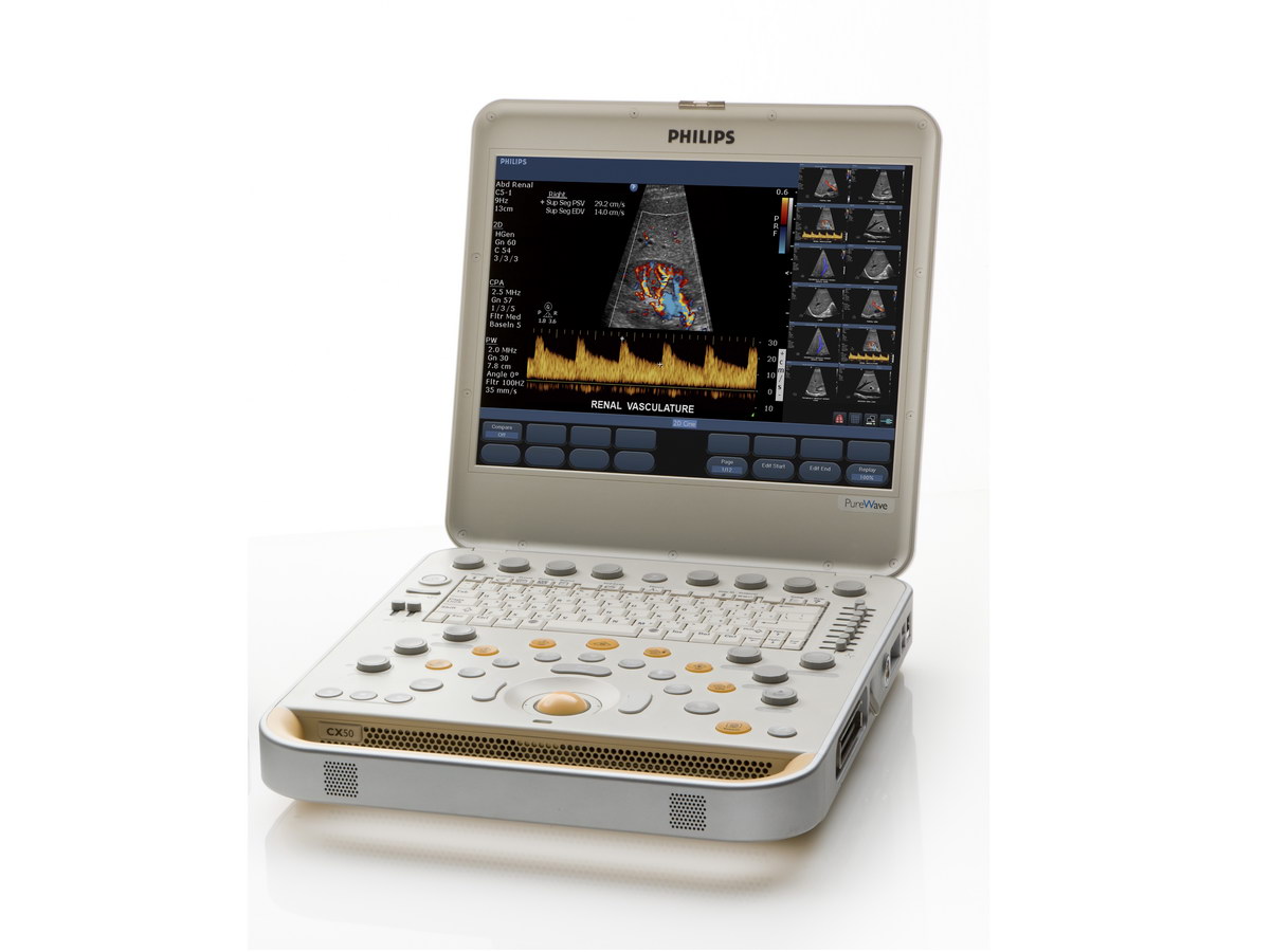 Портативна компактна ультразвукова система преміум-класу CX 50 - фото