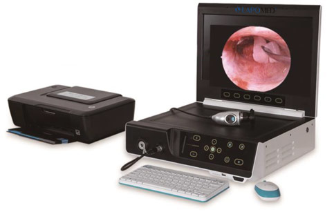 Портативна ендоскопічна камера LAPOMED PFHD-III - фото