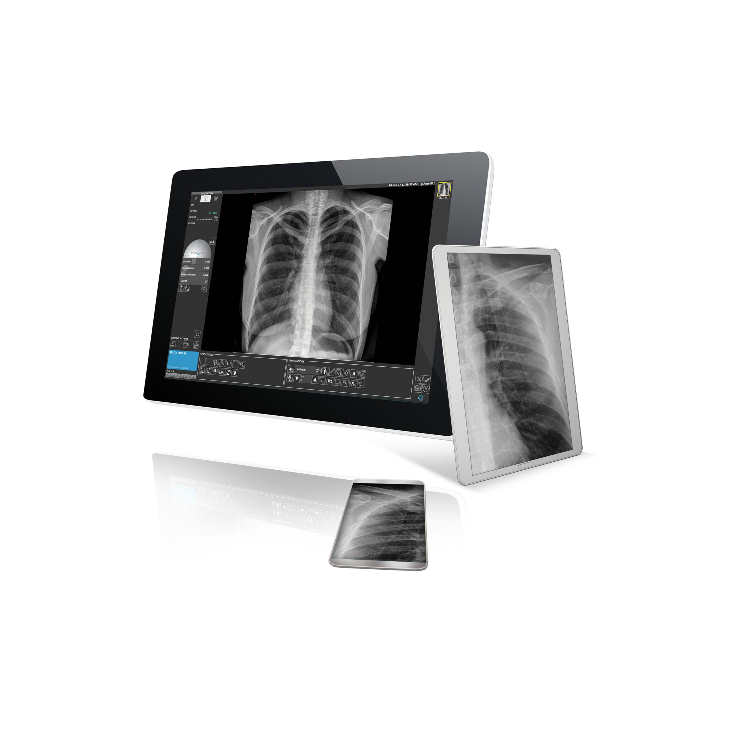 Цифрова система зображень рентгенографії Проектор Avanse DR - фото