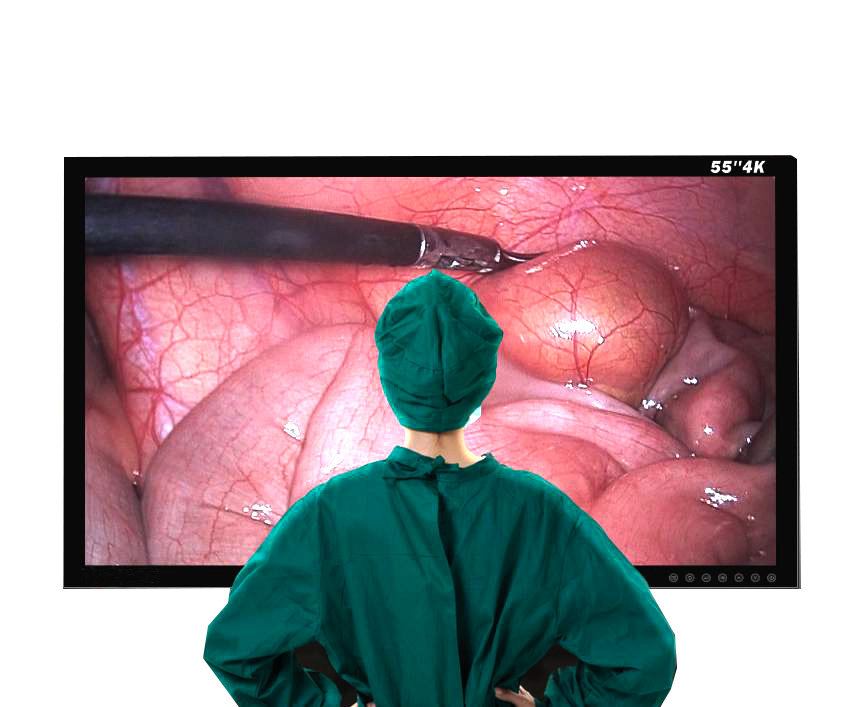Ендоскопічний монітор LAPOMED, 4K, 55 дюймів - фото