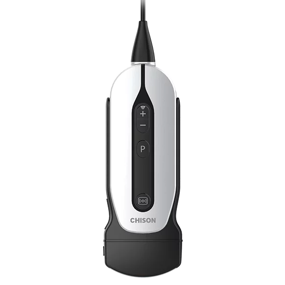 Портативний УЗД для смартфона CHISON SONOEYE P5 (convex +pad дол) - фото