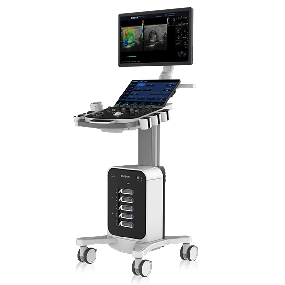 УЗД апарат CHISON SonoMax 7 - фото