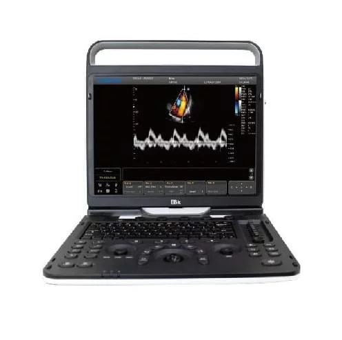 Портативний ультразвуковий сканер Chison SonoTouch 60 (EBit 60)  - фото