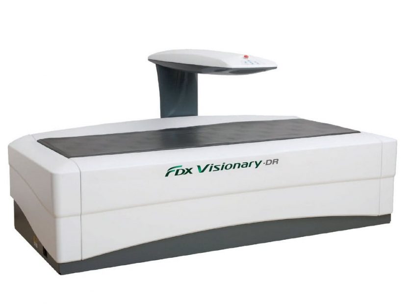 Цифровий денситометр FDX Visionary-DR - фото